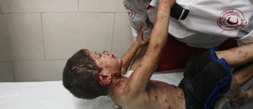 اطباء بلا حدود: اطفال غزة المصابين في الحرب ما زالوا يعالجون