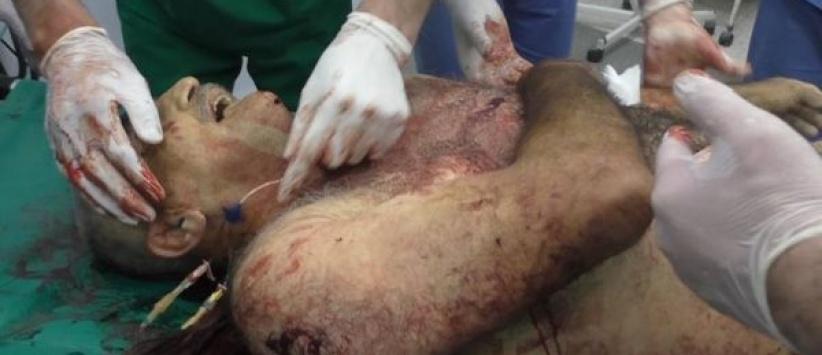 استشهاد مواطن واصابة نجليه في بيت امر بالخليل