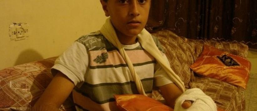 الجليل- بتر أصابع طفل كان يلهو بالمفرقعات