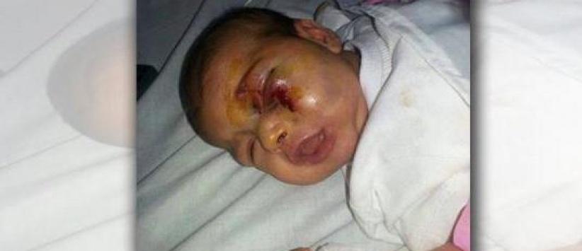 اعتدى على ابنته الرضيعة بشكل وحشي... بسبب بكائها