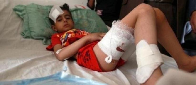 اكثر من 500 طفل قتلوا في اليمن منذ اندلاع النزاع