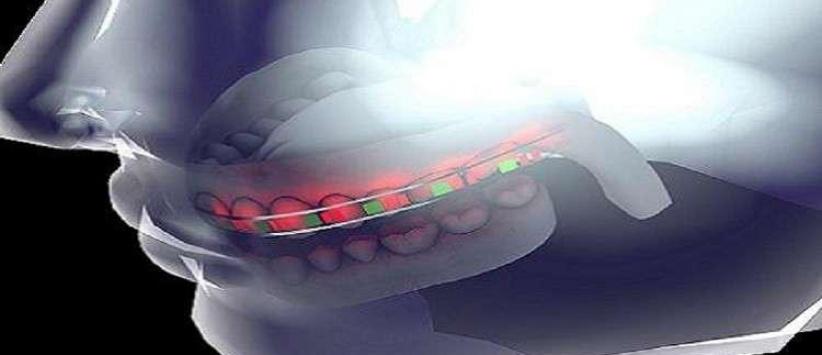 جامعة سعودية تطور تقنية جديدة لتقويم الأسنان