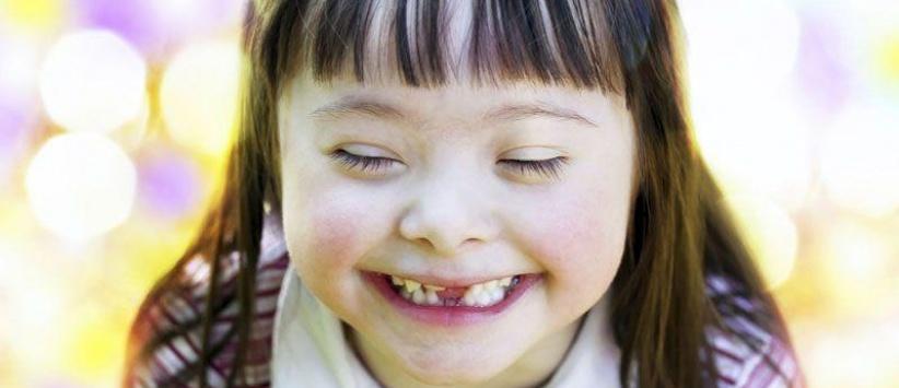 دراسة تبعث الأمل لإيجاد علاج شخصي لمرضى متلازمة داون