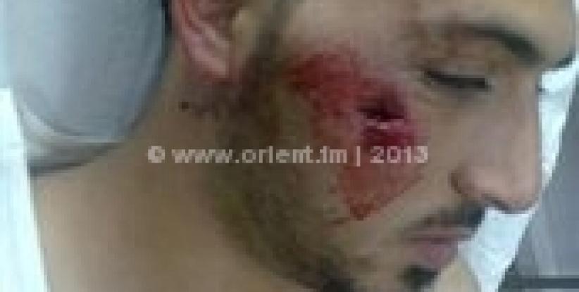 اصابة شاب برصاصة معدنية بوجهه في مواجهات بمخيم عايدة