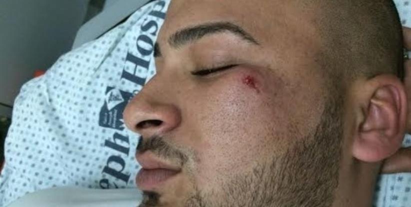 مستوطنون يعتدون على شاب مقدسي بآلة حادة