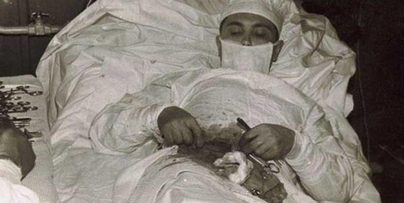 طبيب يجري لنفسه عملية 