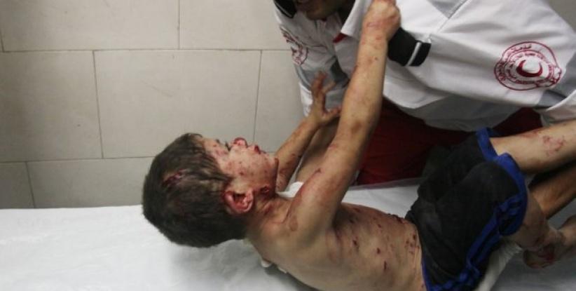 اطباء بلا حدود: اطفال غزة المصابين في الحرب ما زالوا يعالجون