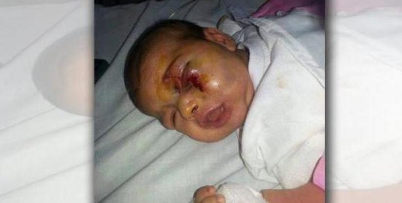 اعتدى على ابنته الرضيعة بشكل وحشي... بسبب بكائها