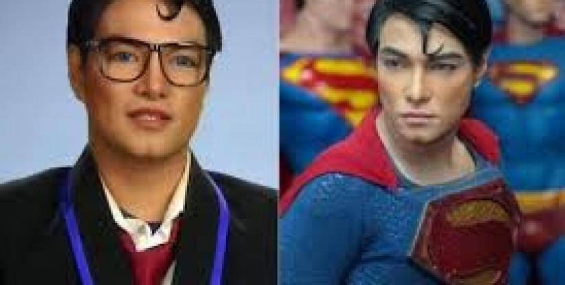 شاب يجري 23 عملية جراحية على مدار 18 عامًا ليتحول إلى 