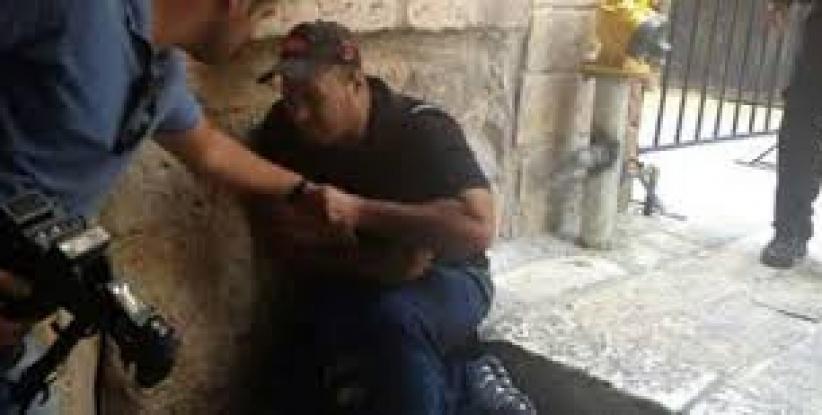 إصابة عدد من الصحفيين بعد اعتداء قوات الاحتلال عليهم في القدس