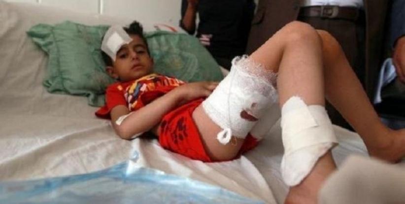 اكثر من 500 طفل قتلوا في اليمن منذ اندلاع النزاع