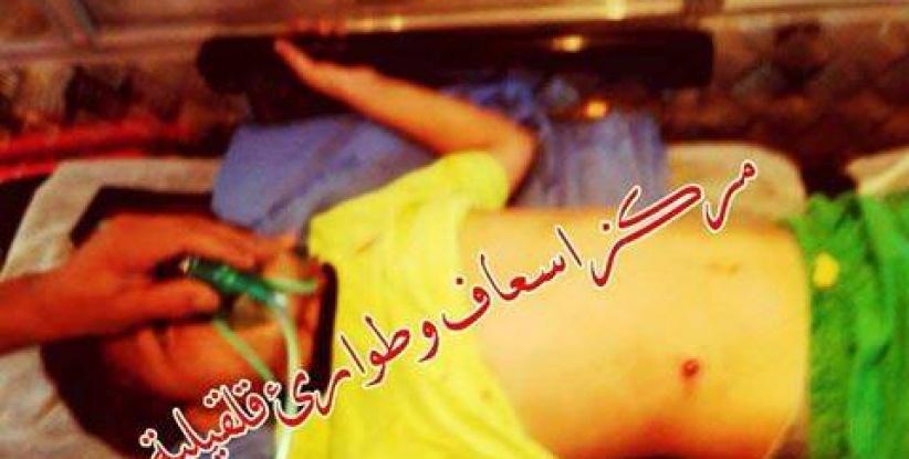 إصابة طفل برصاص مستوطن في قلقيلية