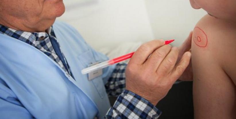 تطوير اختبار سريع يشخّص حالات الحساسية في 8 دقائق