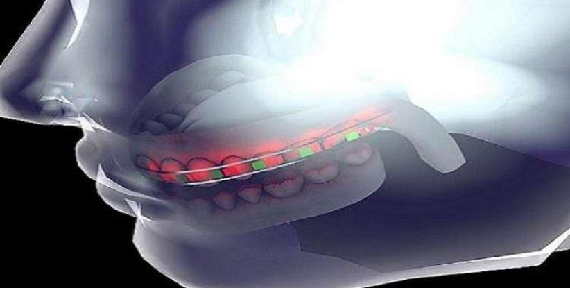 جامعة سعودية تطور تقنية جديدة لتقويم الأسنان