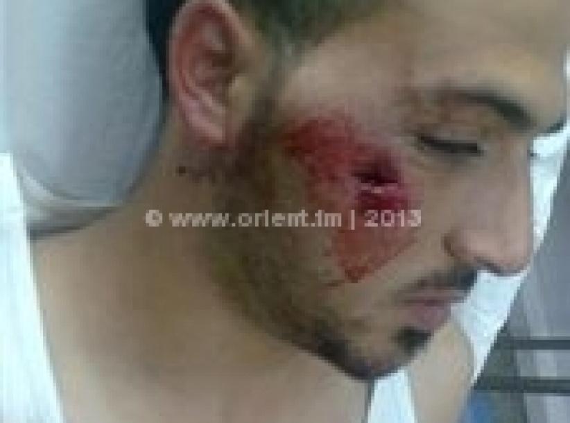 اصابة شاب برصاصة معدنية بوجهه في مواجهات بمخيم عايدة