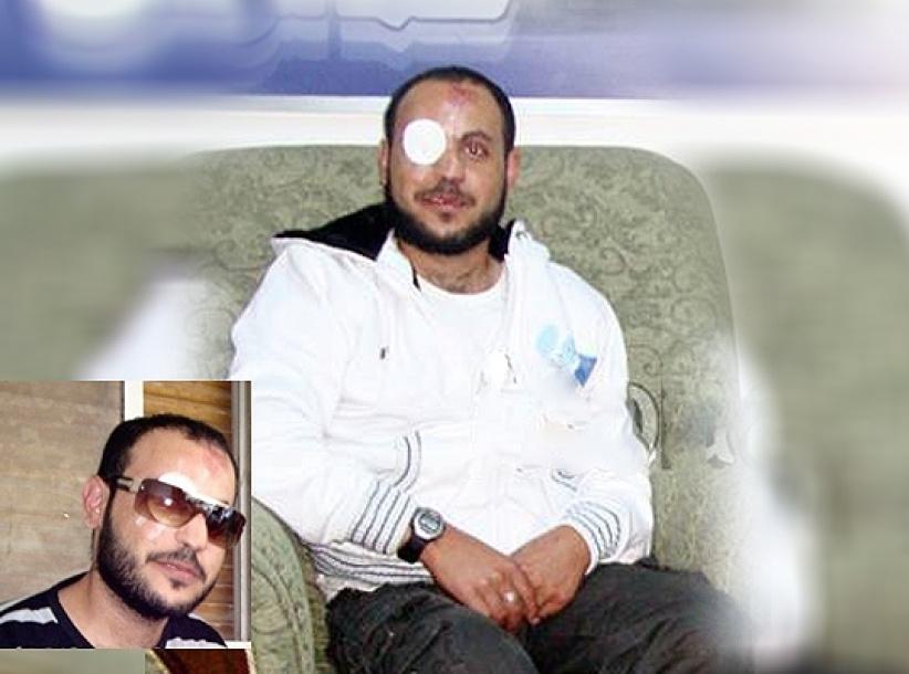 استشهاد شاب من طولكرم متاثرا بجراح اصيب بها على يد الاحتلال قبل 9 سنوات