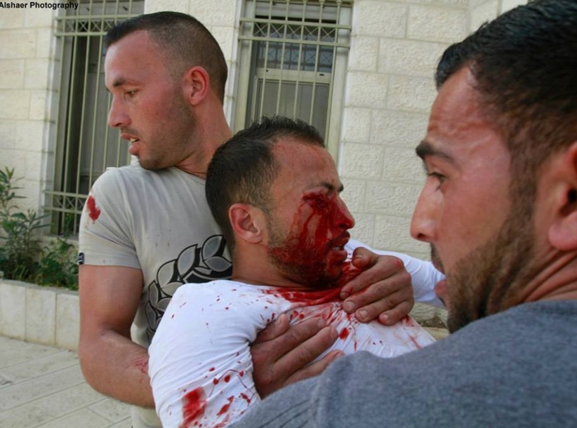 اصابة شاب برصاصة معدنية في عينه خلال مواجهات في بلدة تقوع