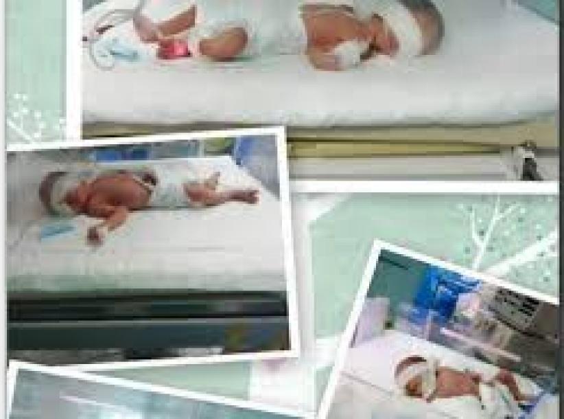 سيدة من غزة ترزق بأربع توائم في عملية ” اخصاب مجهري ” بعد عدم توفر هذه الامكانية في غزة