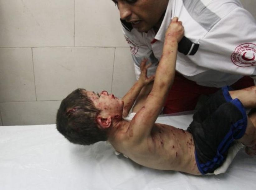 اطباء بلا حدود: اطفال غزة المصابين في الحرب ما زالوا يعالجون