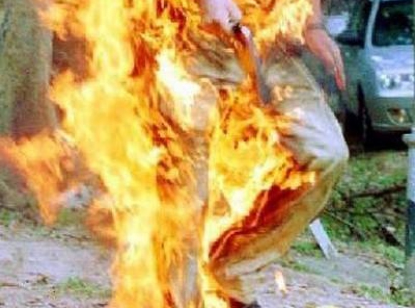 وفاة شاب أضرم النار في نفسه بغزة