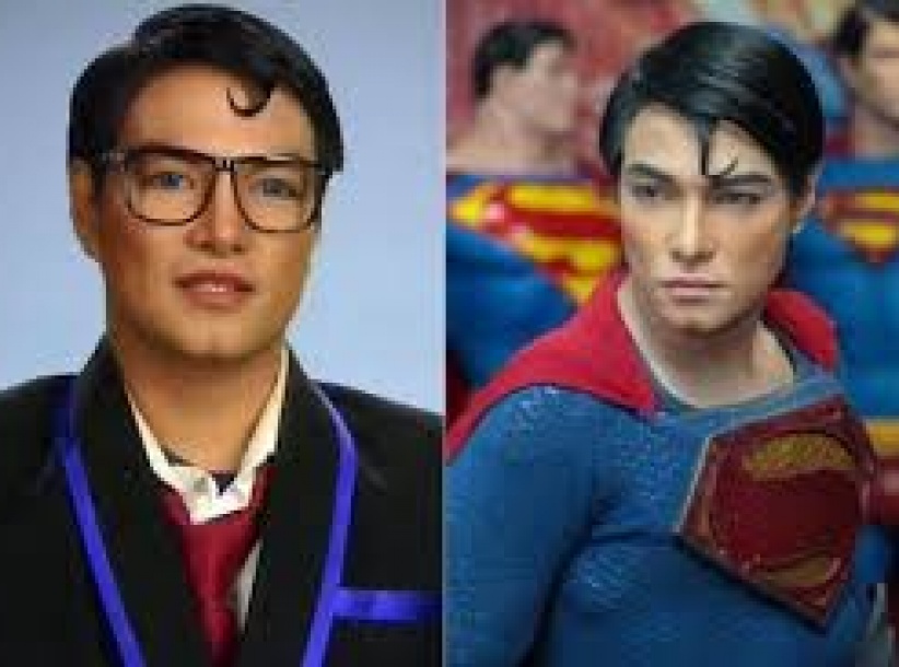 شاب يجري 23 عملية جراحية على مدار 18 عامًا ليتحول إلى 