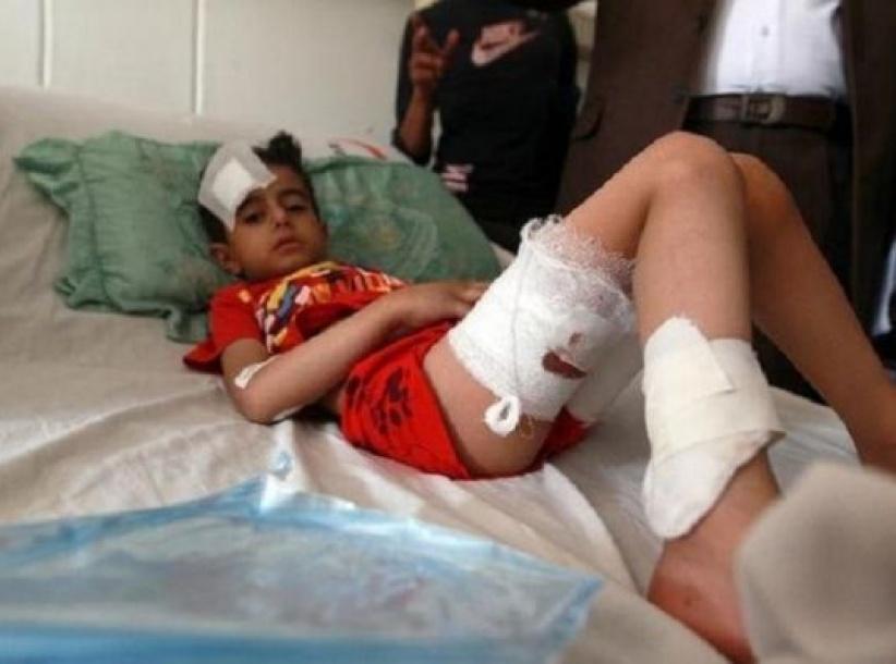 اكثر من 500 طفل قتلوا في اليمن منذ اندلاع النزاع