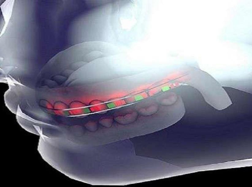 جامعة سعودية تطور تقنية جديدة لتقويم الأسنان