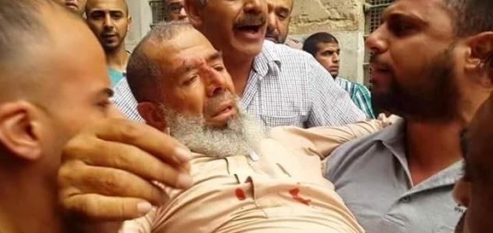 إصابة مسن باعتداء الاحتلال عليه قرب المسجد الأقصى