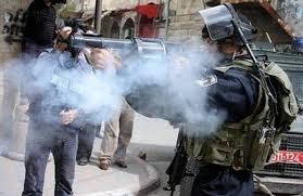 إصابة شاب بالرصاص الحي شمال بيت لحم