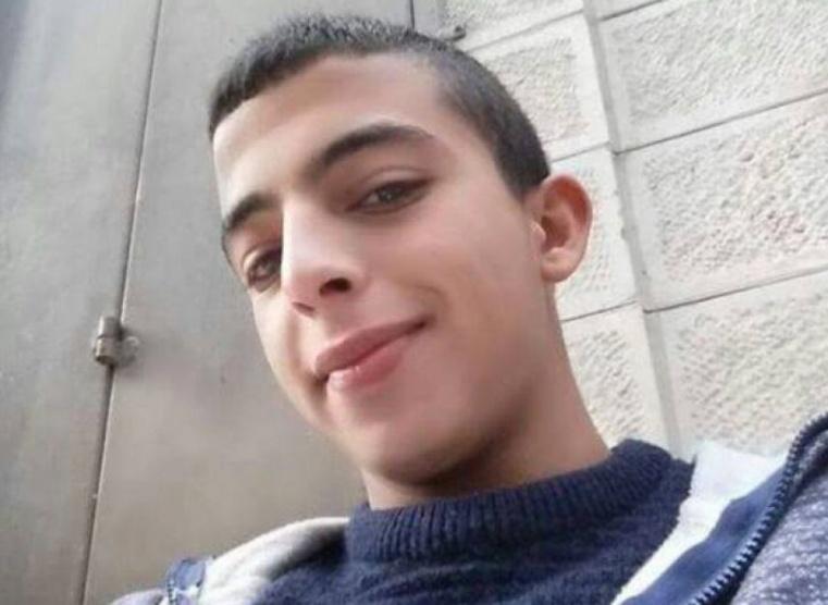 فتى مقدسي يفقد عينه اليسرى بعد إصابته بعيار مطاطي