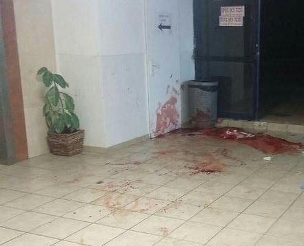 اصابة حارس أمن بجراح حرجة في عملية طعن بمعاليه ادوميم