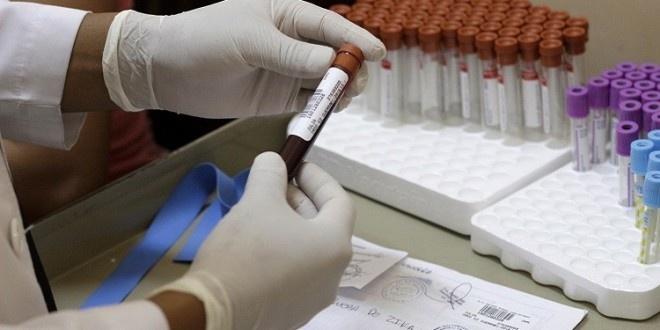  اكتشاف 4 حالات مصابة بـ”زيكا” في الاراضي المحتلة