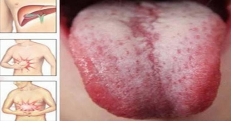علامات وعوارض تدل على أن الجسم مليء بالسموم