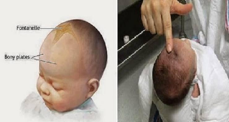 هل يجوز لمس رأس الطفل حديث الولادة؟