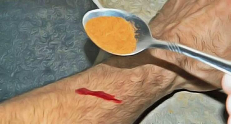 كيف توقفون النزيف في 15 ثانية فقط؟