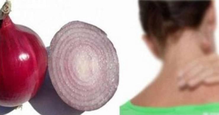 وضعت بصلة حمراء حول عنقها فتسببت بشيء لن تصدقه ابداً!