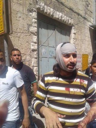 اصابة فلسطيني بعد اعتداء المستوطنين عليه في الخليل