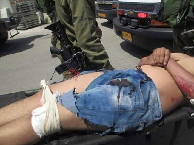 مستوطن يدهس شاباً قرب المسجد الابراهيمي