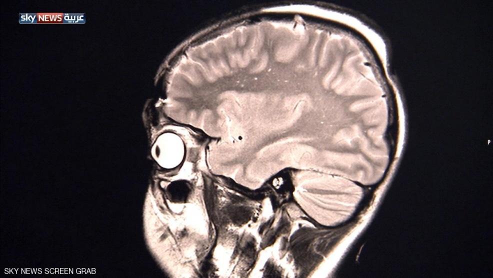 دراسة: سلوك متعاطي المخدرات 