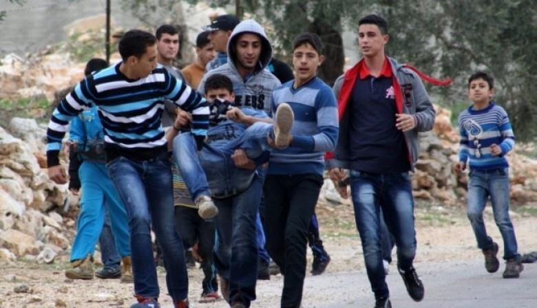 اصابة طفل مقدسي بعيار مطاطي في رأسه