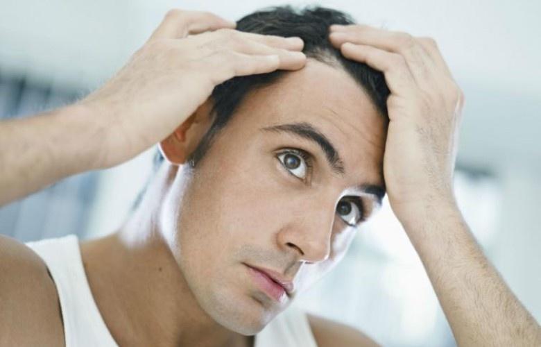 متى تستلزم قشرة الرأس استشارة الطبيب؟