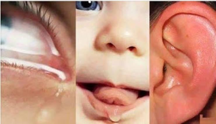 هل تعلم لماذا ماء العين مالحاً !! ﻭماء ﺍلأﺫﻥ مراً وماء الفم عذباً !!