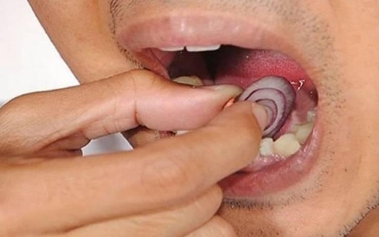 ماذا يحدث إذا وضعتم شريحة بصل على أسنانكم؟