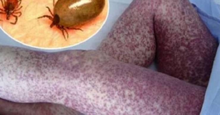 علميا : حقائق مخيفة عن النوم بجانب الحيوانات الاليفة
