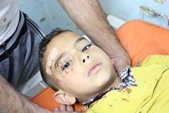 إصابة طفلين ووالدهما جراء انهيار أجزاء من سقف منزلهم في خانيونس