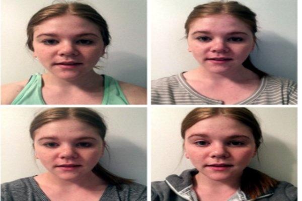 صور- كانت تعاني من الحبوب..لكنها وجدت حلاً سحرياً في أسبوع فقط