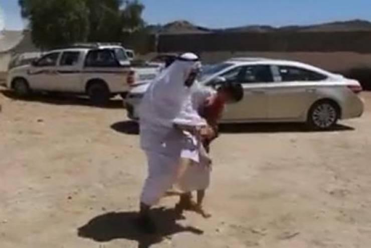 شاهد ماذا حدث لطفل بسبب الألعاب النارية؟