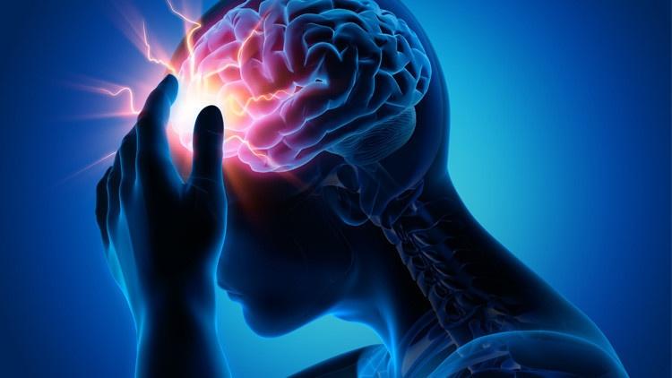90% من حالات الإصابة بسكتة الدماغ يمكن تجنبها