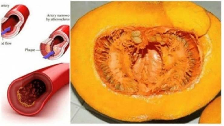 نظفوا دمكم من السموم خلال شهر بواسطة هذا العصير فقط!
