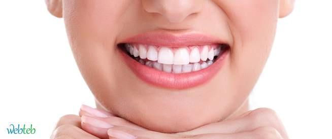 تلبيسة الأسنان الجزئية وابتسامة المليون دولار